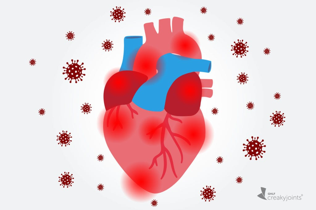 Di chứng tim mạch hậu F0: Làm sao để giảm nhẹ?
