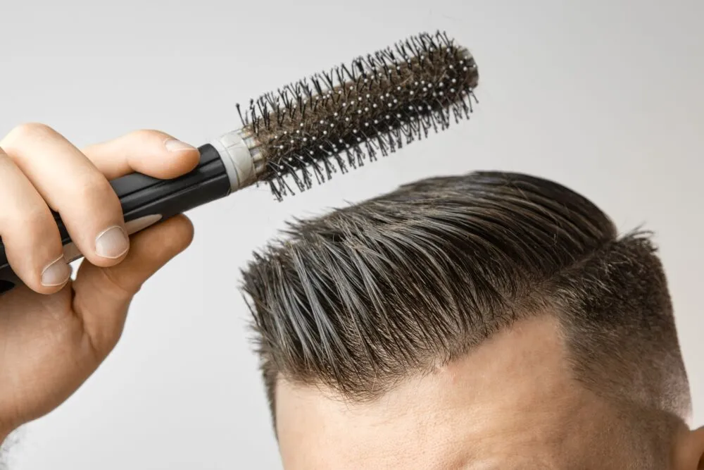 Góc nhìn của chuyên gia da liễu về các vấn đề tóc nam giới phổ biến hiện nay?