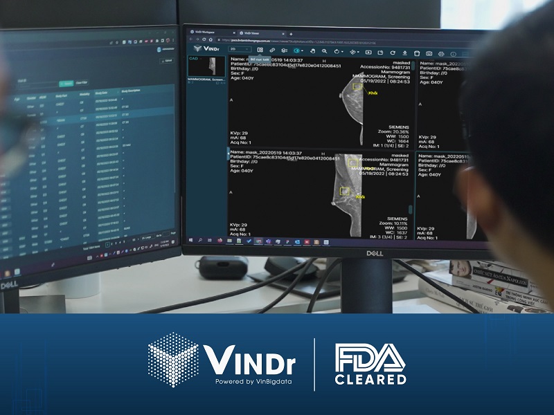 Sản phẩm AI của VinBigdata đạt chứng nhận của FDA, chính thức tiến vào thị trường Mỹ