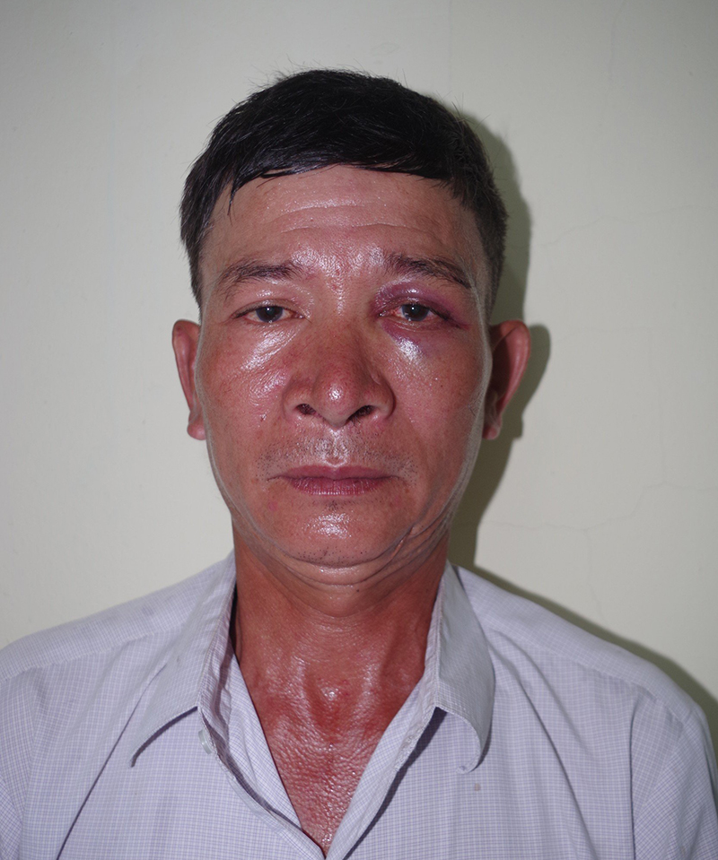 Bắt đối tượng vào nơi trông giữ xe của bệnh viện để lừa đảo