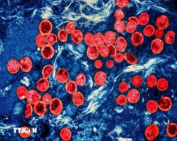 Bộ Y tế: Tăng giám sát, phát hiện ca nghi ngờ đậu mùa khỉ từ cửa khẩu