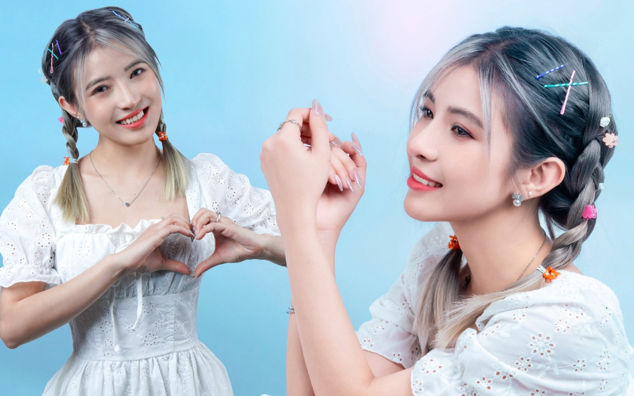 Ứng dụng kỹ thuật V-Y-Z trong tạo hình mũi dị tật