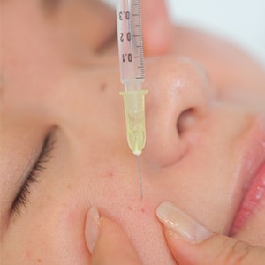 Bị nổi mụn mãi không hết - Đừng vội bỏ qua bài viết này!